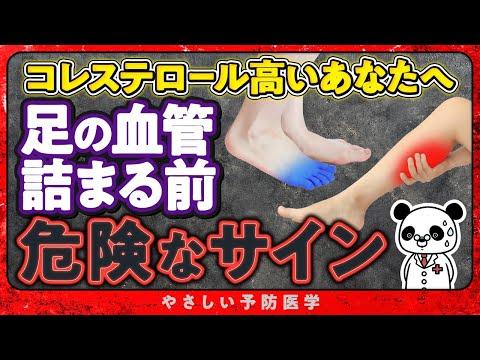 動脈硬化と足の血管の健康についての重要な情報