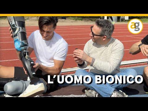 The Incredible World of Bionic Prosthetics