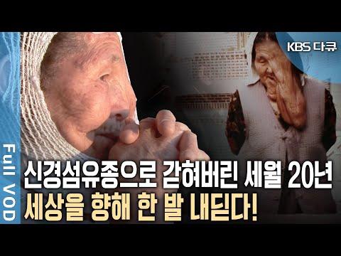 할머니의 감동적인 이야기: 혹에 갇힌 세월을 뛰어넘다