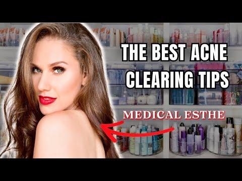 Achieving Clear Skin: Expert Tips and Insights