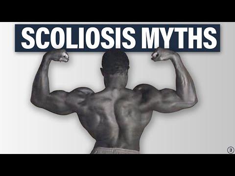 Understanding Scoliosis: Diagnosis, Treatment, and Physical Activity