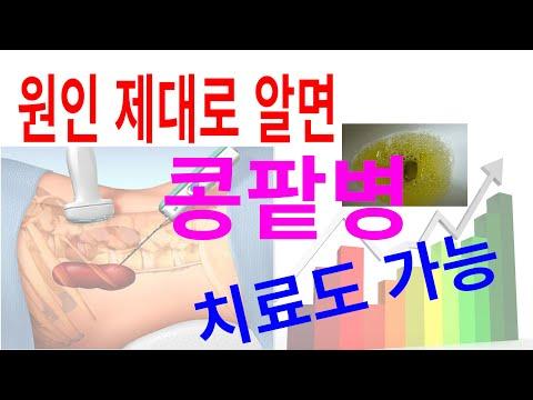 신부전: 조직검사를 피하지 말고, 제때 대처하자