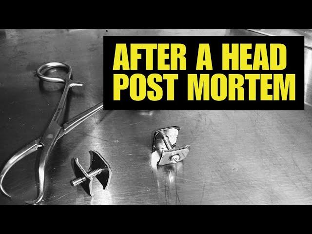 Revolutionizing Head Post Mortems: A Comprehensive Guide