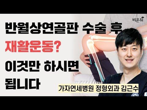 반월상 연골판 수술 후 재활 운동, 전문가의 조언