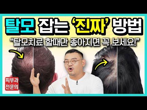 신개념 탈모 치료법! 몸과 머리 모두 건강하게