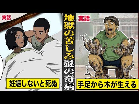 【実話】世界でも数名...治療法不明な謎の奇病。妊娠しないと死ぬ奇病...手足に木が生える奇病など。