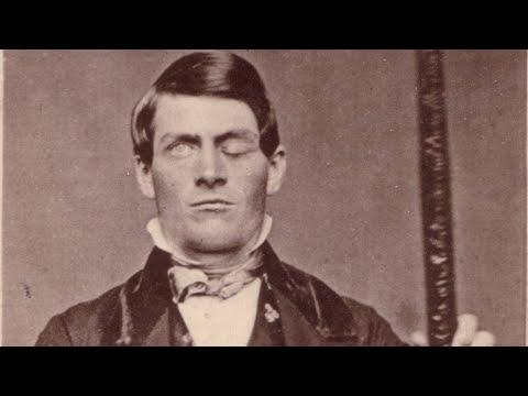 Unveiling the Truth About Phineas Gage: Debunking Myths and Revealing Facts