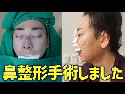 韓国で鼻の整形手術を受ける際のポイントと注意点