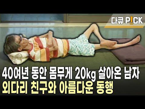 외다리 친구와의 우정, 10살 때 성장이 멈춰 앙상한 뼈만 남은 인철씨 이야기