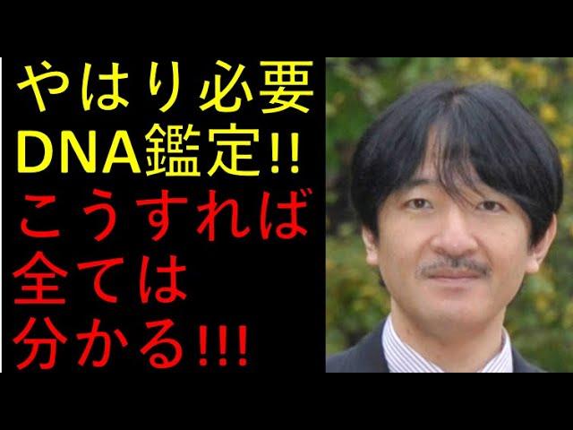 DNA鑑定の重要性と日本の遅れに関する情報