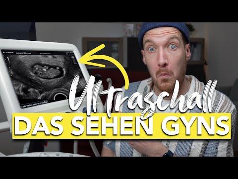 Alles, was Sie über Ultraschall in der Schwangerschaft wissen müssen