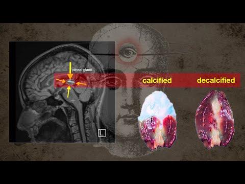 Unlocking the Power of the Pineal Gland: A Guide to Decalcification and Personal Growth