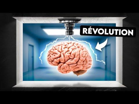 Les découvertes révolutionnaires de l'IRM pour notre cerveau