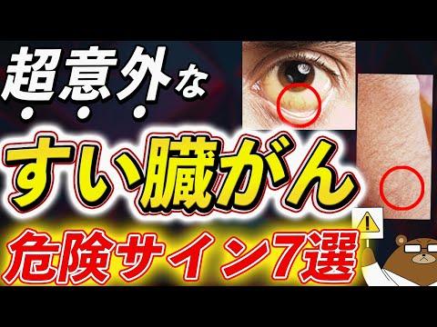 すい臓がんの初期症状と予防法：医師が徹底解説