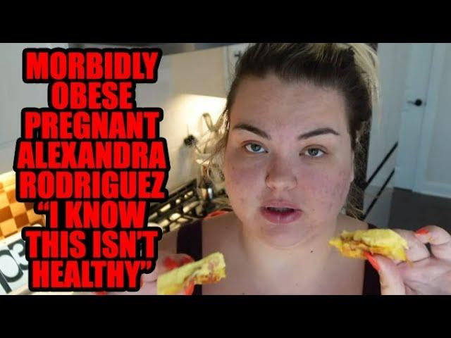 Unveiling the Health Journey of Morbidly Obese Pregnant Alexandra Rodriguez