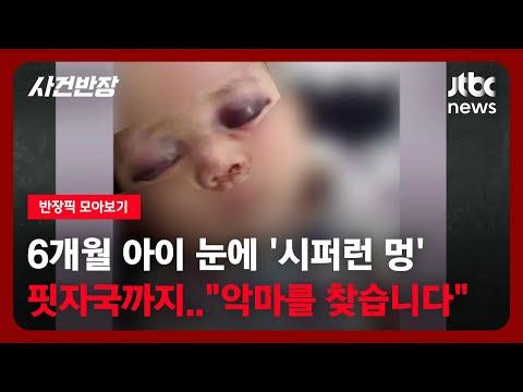 [반장픽 모아보기] 생후 6개월 아이 눈에 '시퍼런 멍'…부모와 동거인의 엇갈린 주장 / JTBC 사건반장