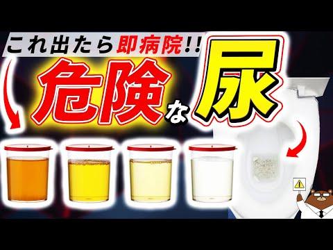 おしっこの色・臭い・泡立ち・回数..絶対に見逃してはいけない「おしっこ」からのSOS。知らないと後悔する超意外なサインとは？医師が徹底解説！