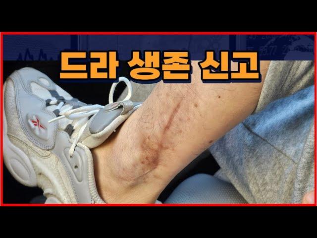 자동차 시장의 미래: 스마트폰과의 유사한 변화