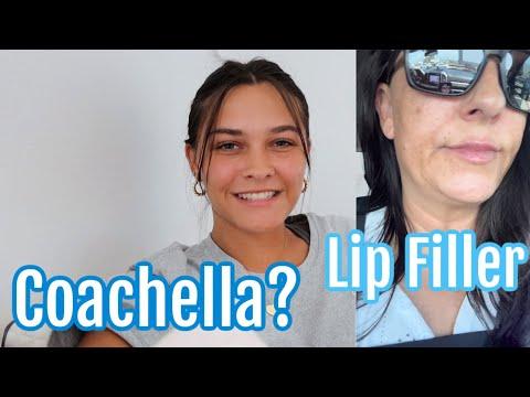 Emma's Lip Filler Journey and Jam-Packed Schedule: What You Need to Know