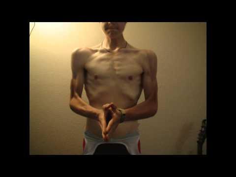 ErikTheElectric: Overcoming Anorexia and Exercise Obsession