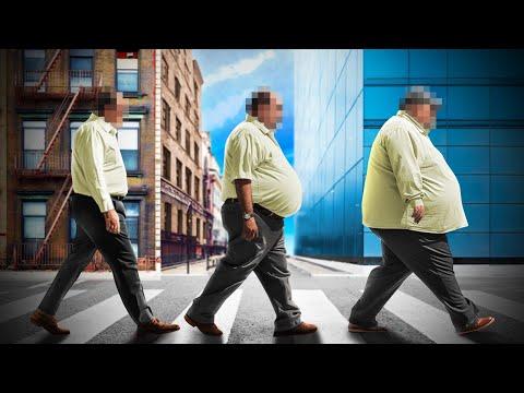 La nouvelle épidémie d'obésité : Solutions et préoccupations