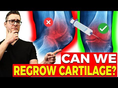 Revolutionizing Cartilage Regeneration: New Insights and Treatments