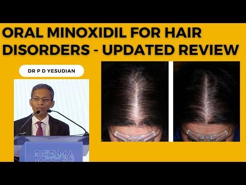 Unlocking the Power of Oral Minoxidil for Hair Loss: Expert Insights